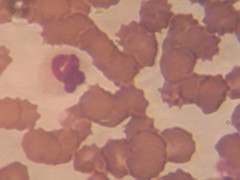 Imagen de microscopio. Extensión de sangre Glóbulos rojos y leucocito del perro